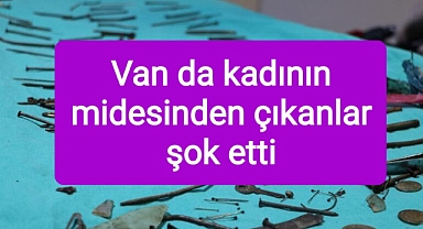 Midesinden çıkanlar şok etti