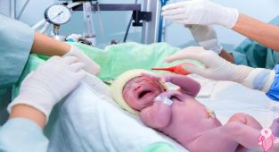 Bebeğiniz Prematüre doğduysa Beslenmesinde Dikkat Edilmesi Gerekenler