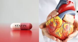 Statin kimlere verilir? Kolesterol ilaci ne zaman birakilir? Kolesterol kaç olursa ilaç kullanmak gerekir? Statin ne icin kullanilir?